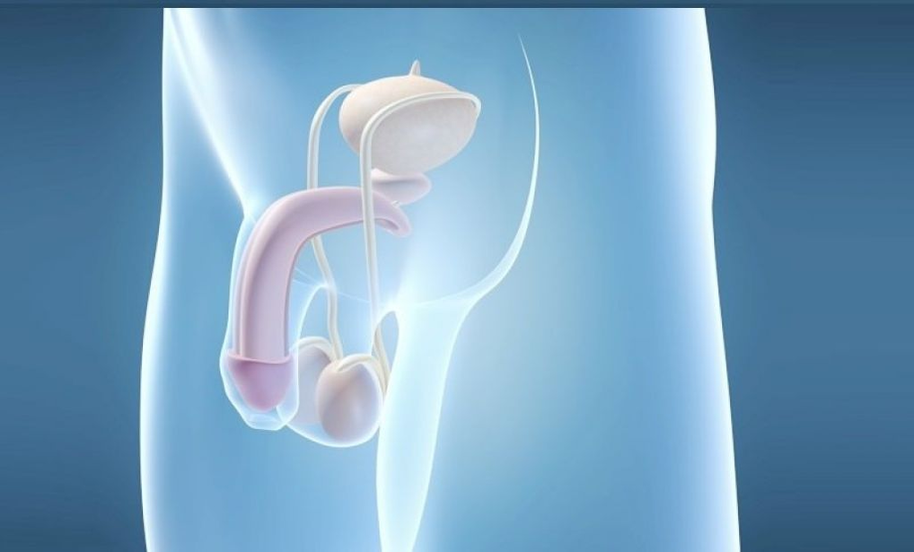Die Prothesenimplantation ist eine chirurgische Methode zur Vergrößerung des männlichen Penis